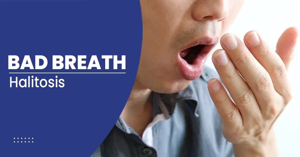 Bad breath - causes and treatment