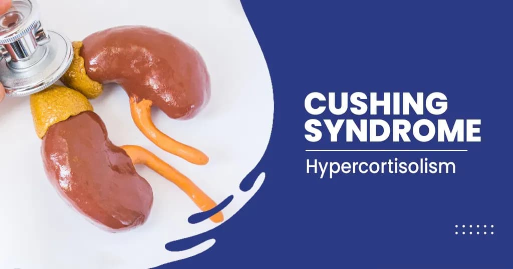 Cushing syndrome – Symptoms, Diagnosis, and Treatments