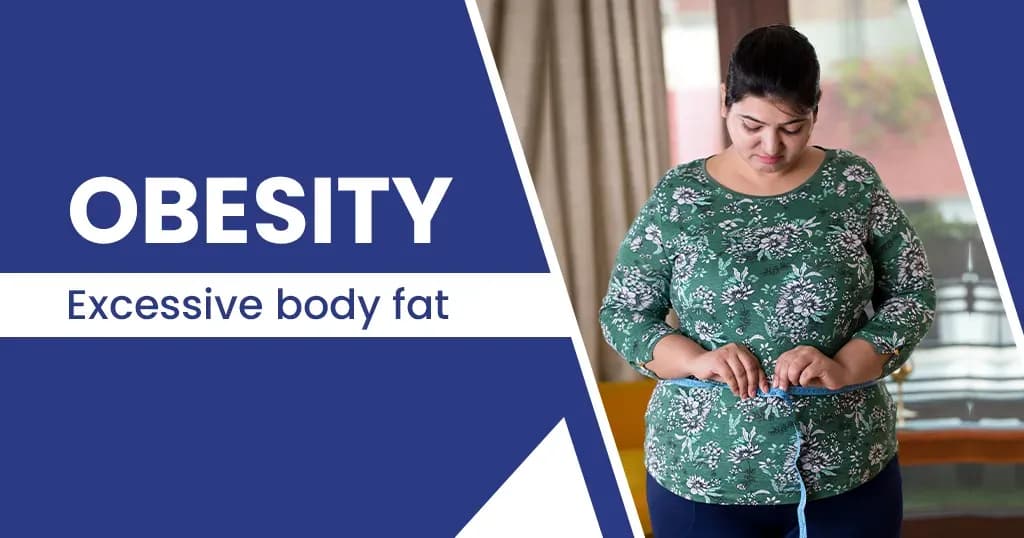 Obesity – Symptoms, Risk factors, Causes, Prevention and more